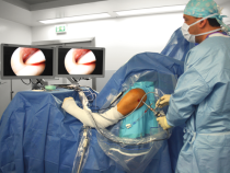 La chirurgie arthroscopique : Une révolution dans le domaine de l’orthopédie