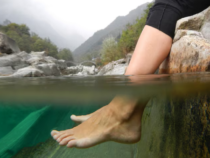 Pédicure fish spa : attention aux risques d’infection